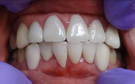 best cosmetic dentist in hyderabad