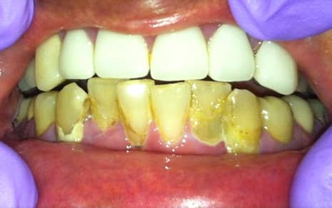 best cosmetic dentist in delhi