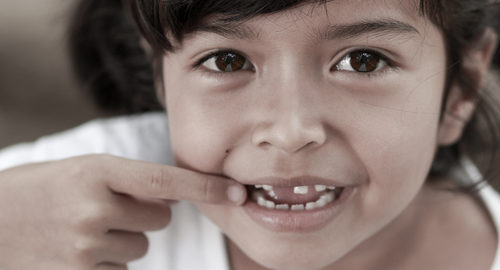Milk Teeth Need Care Too!