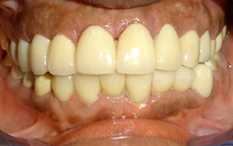 Cosmetic Dentistry