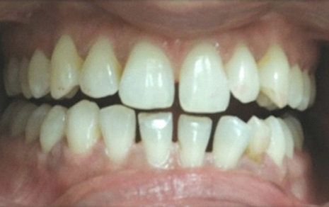 cosmetic dentist in delhi