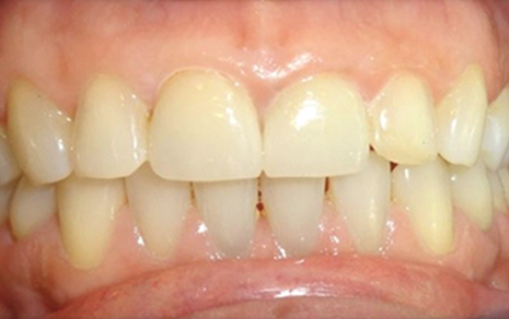 Cosmetic Dentist Delhi