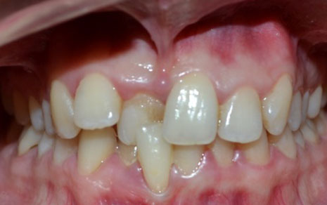 best orthodontist in delhi