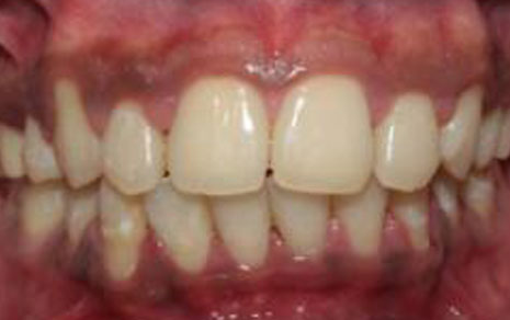 best orthodontist near me