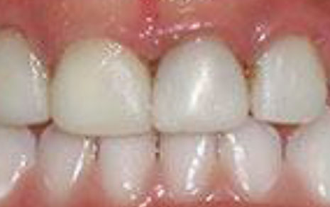  Pediatric Dentists Delhi