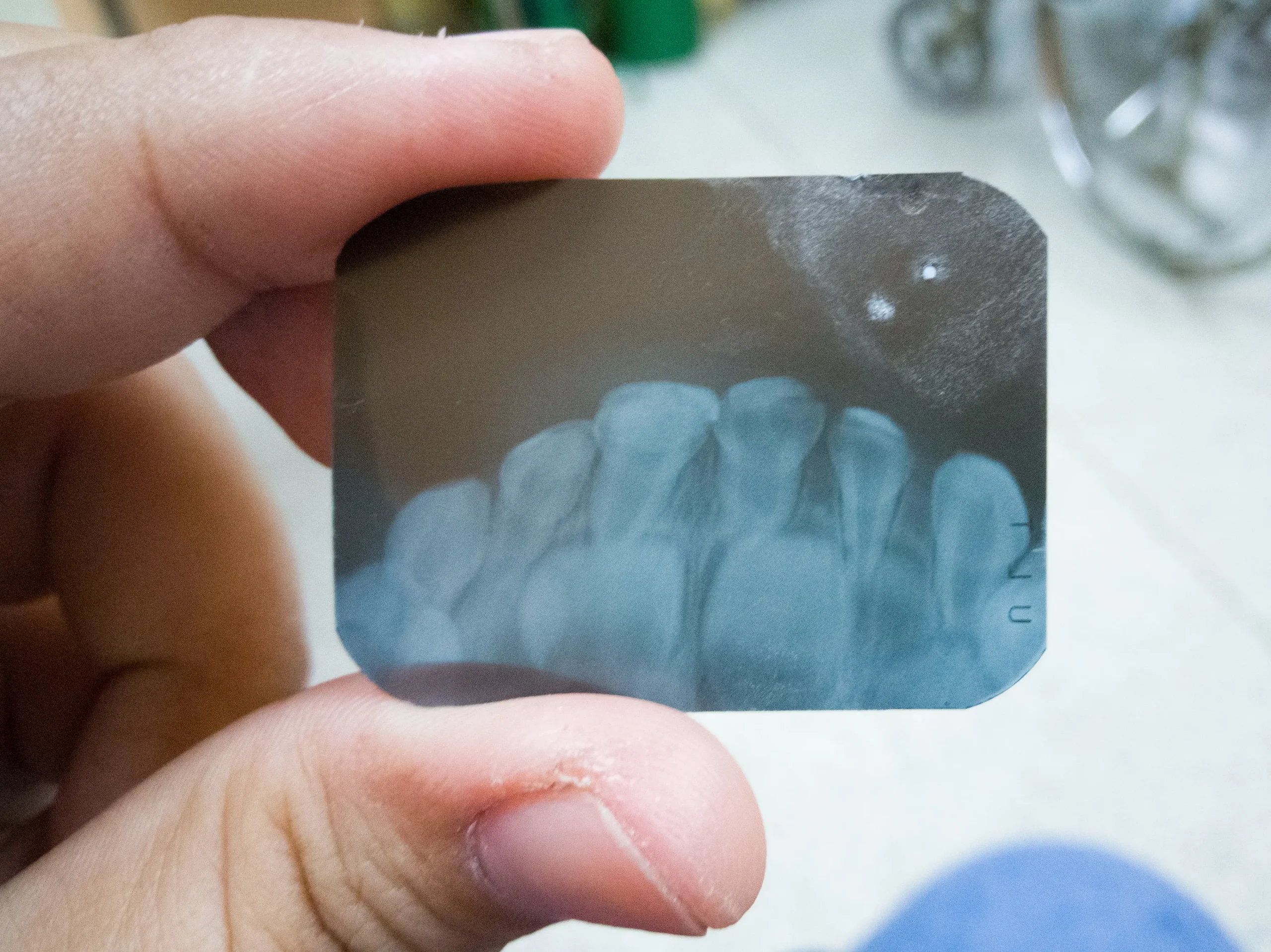 Removing soft tissue