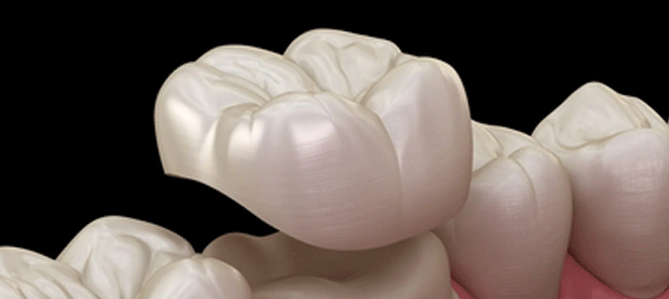 Dental Crown Care