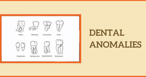 Dental Anomalies