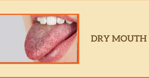 Dry Mouth