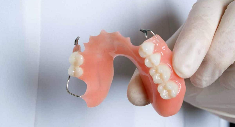 Partial Dentures
