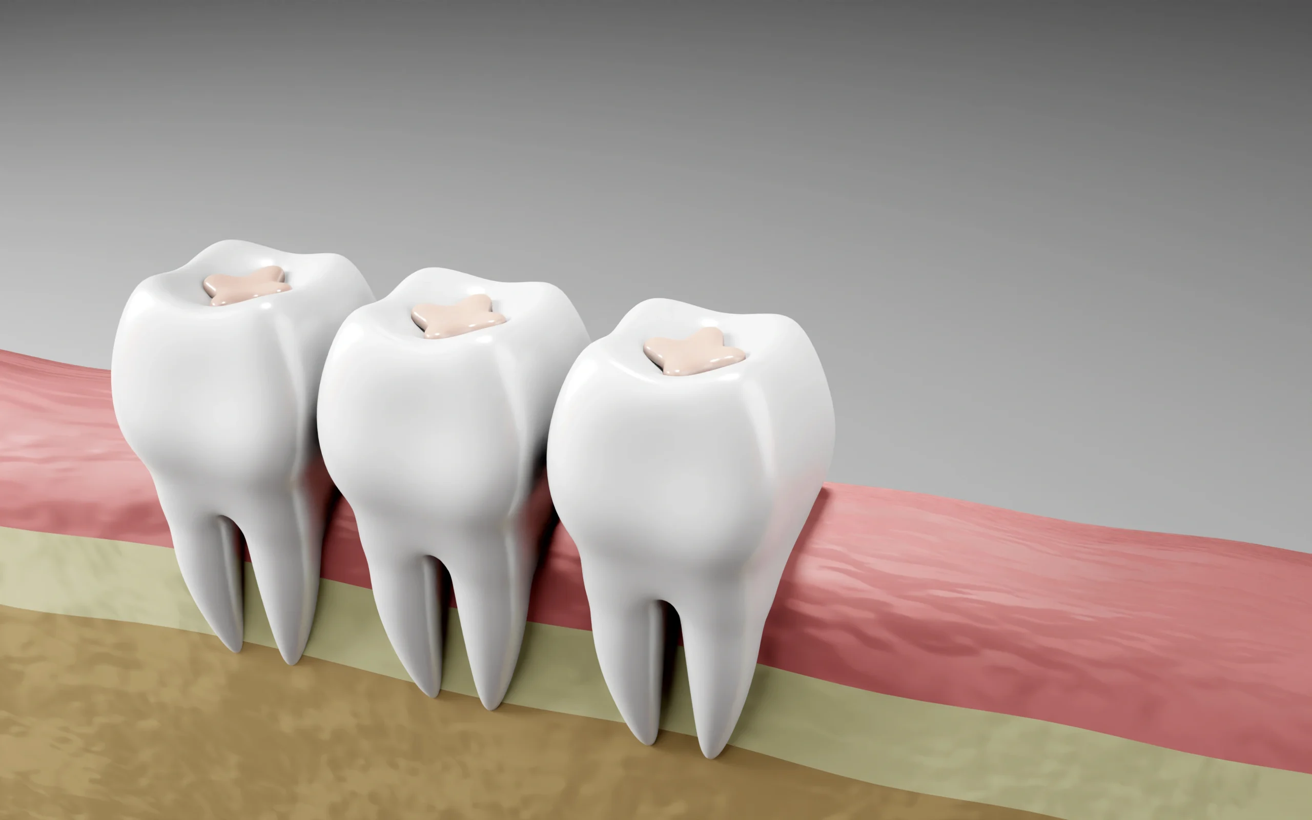 Removing soft tissue