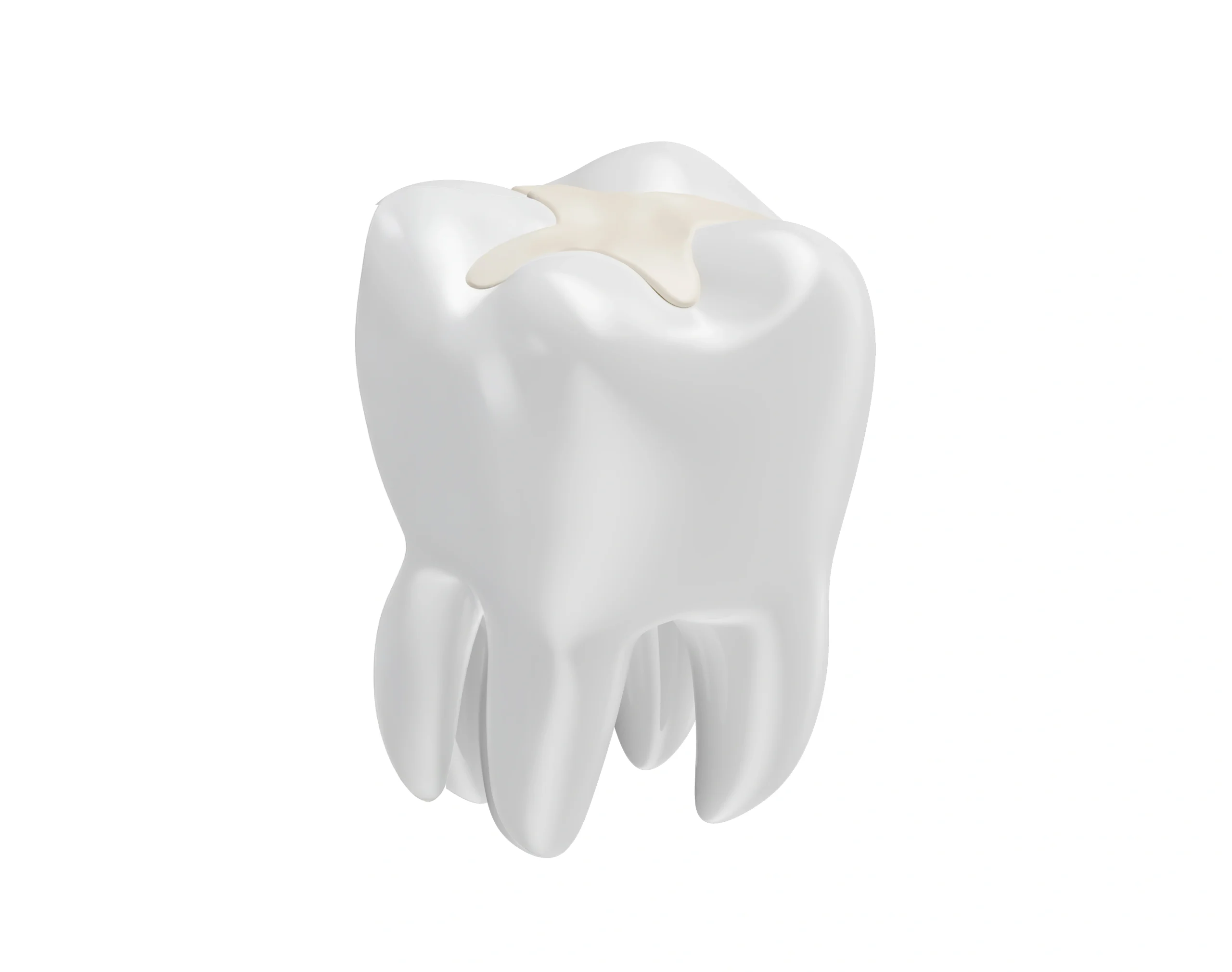 Treating tongue frenulum