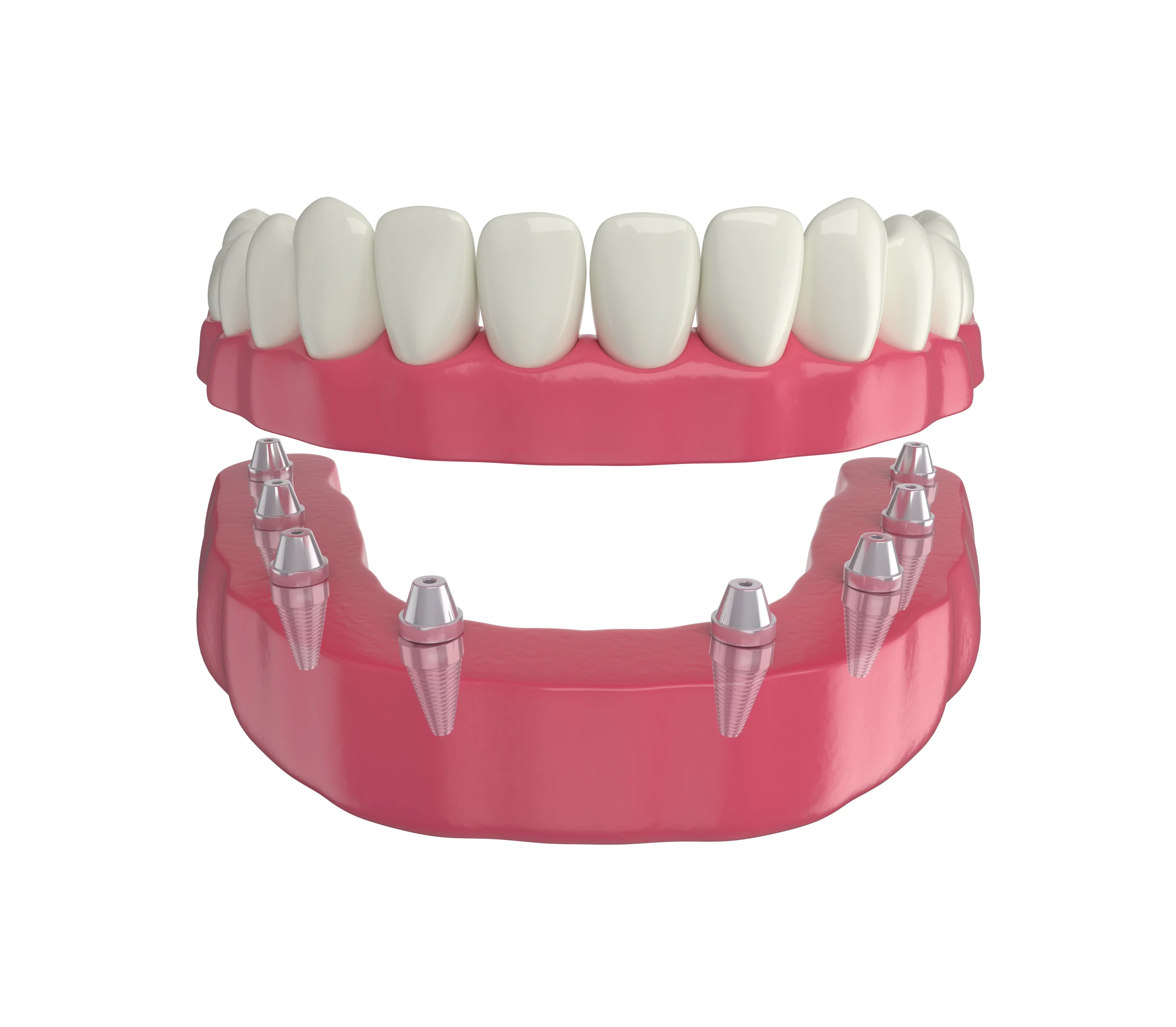 Removing soft tissue